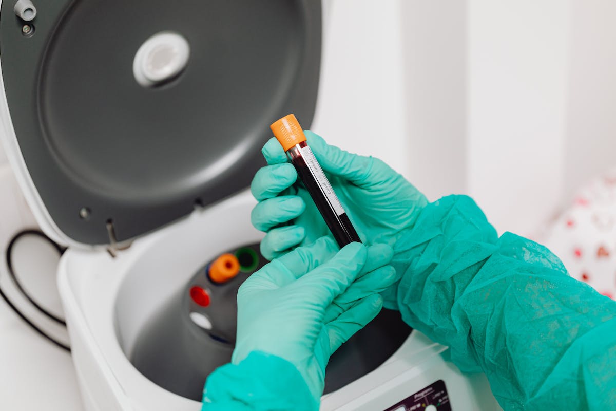 Sample validation near centrifuge